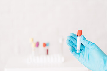 Hand holding plastic flask against the background of test tubes.