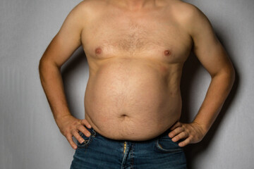 A Studio Photograph of An Overweight Caucasian Man