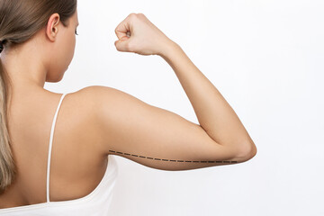 Cropped shot of a young woman with excess fat on her upper arm with marks for liposuction or plastic surgery isolated on a white background. Loose and saggy muscles. Overweight. Beauty concept