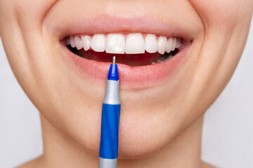 Cropped shot of a young woman pointing to white spot on the tooth enamel with a pen. Oral hygiene,...