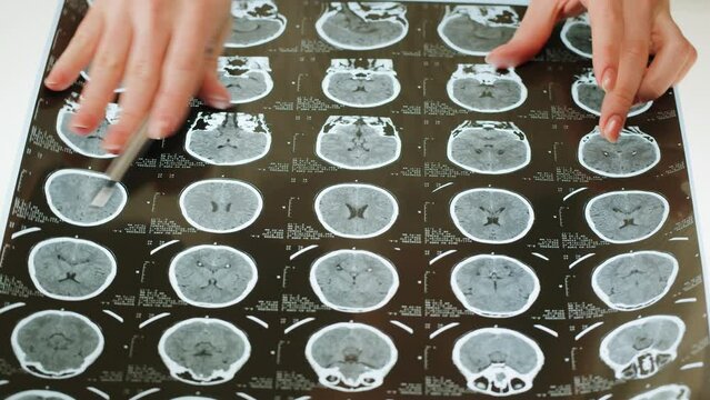 X-ray, Magnetic resonance image of head, human brain MRI close-up. Advanced research of body, doctor examining checkup tomography. 