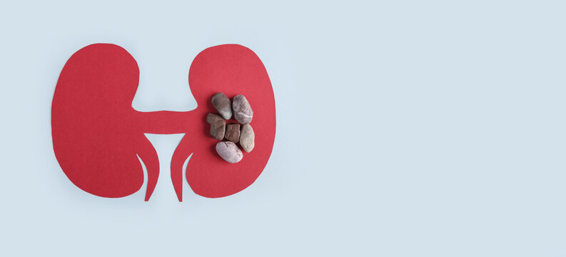 Kidney - human organs from paper on blue background. World kidney day and national organ donor day concept. Kidney stones