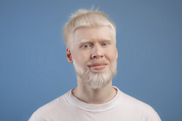 Skin abnormality concept. Portrait of bearded handsome albino guy posing to camera over blue studio...