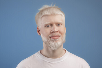 Obraz premium Skin abnormality concept. Portrait of bearded handsome albino guy posing to camera over blue studio background