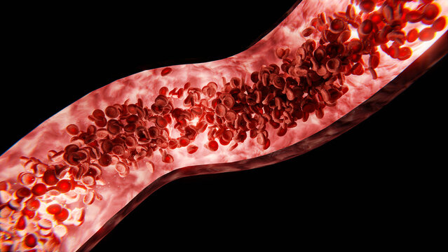Blut in Ader - rote Blutkörperchen oder rote Blutplättchen in Ader