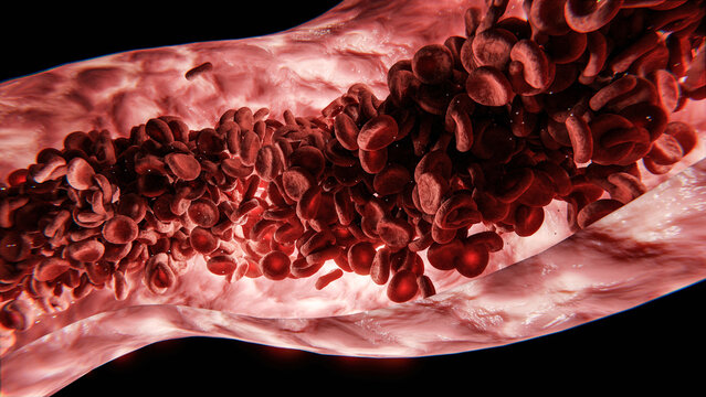 Blut - rote Blutkörperchen oder Blutzellen in Ader - Konzept Bluthochdruck oder Herzinfarkt