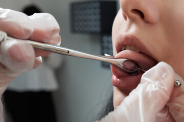 Tongue piercing operation Professional holding the jewel.