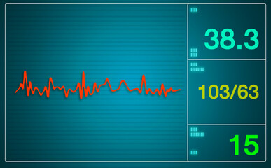Patient monitor showing vital signs ECG and EKG.