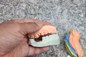 It is a procedure for making a dental model. before submitting the work to the dentist
