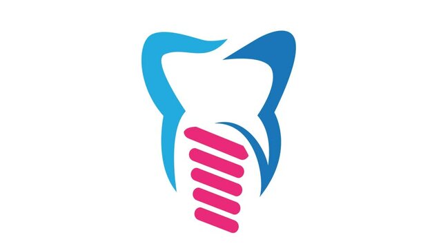 Dental implant. Icon for dentist, dental clinic and dental technician. Motion graphics.