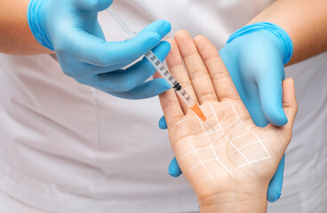 The cosmetologist makes injections of botulinum toxin on the palms of a woman against...