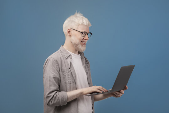 Happy albino freelancer guy working online on laptop, holding computer while browsing internet, blue background