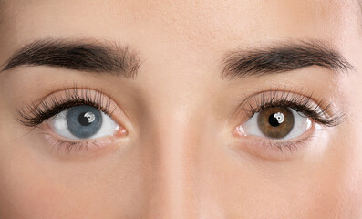 Obraz premium Woman with different colors of eyes, closeup. Heterochromia iridis