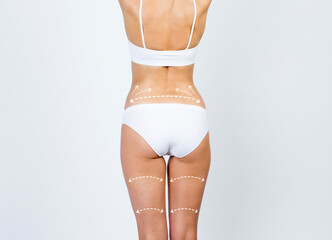 Cellulite removal scheme on body girl. White arrows markings on white body close up. - 501419443