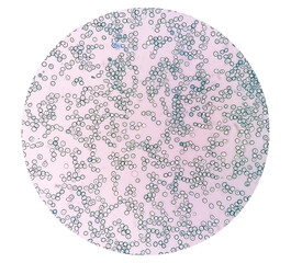 Close view of Reticulocyte count under microscope, methylene blue staining