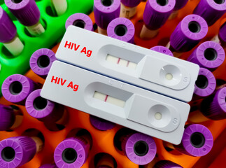 Rapid test cassette for HIV antigen, AIDS
