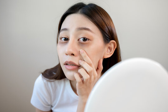 Sleepless Asian woman looking her face in the mirror and worry about dark circles under eyes