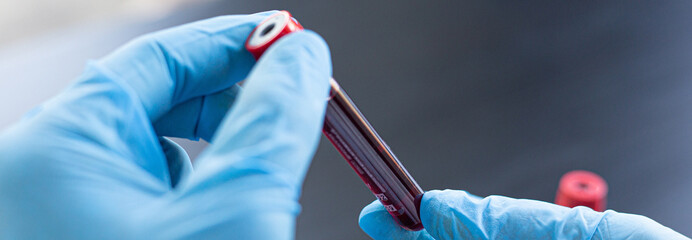 Scientists or doctors collect blood samples from new strains of virus patients for analysis and...