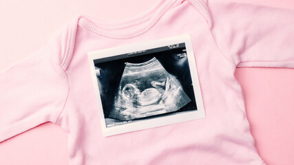 Ultrasound photo pregnancy baby. Fashion cute baby cloth with ultrasound pregnancy picture on pink...