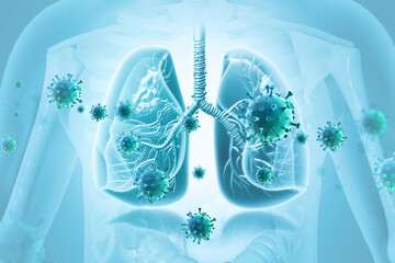 Cancer cells infected the Human Respiratory System.3d illustration - obrazy, fototapety, plakaty