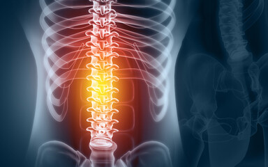 Human spine pain, x-ray view, Spine injury pain. 3d illustration