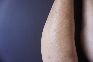 Woman's leg with messy shin hair on black background. Leg hair is the hair that grows on the human...