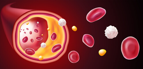 3D Illustration of red blood cells, white blood cells and cholesterol clogging the cause of death. medical use science, education