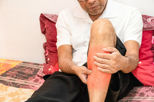 massage therapy, A man on a bed is Distal Guillain-Barr&eacute; syndrome (DGBS), which usually presents with predominantly motor involvement