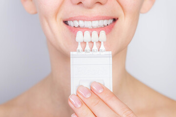 Tooth whitening, perfect white teeth close up with shade guide bleach color, female veneer smile,...