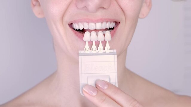 Perfect white teeth close up with shade guide bleach color, female veneer smile, dental care and stomatology, dentistry