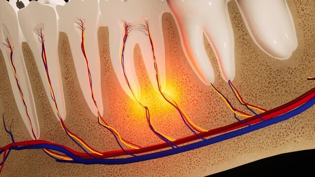 Toothache. Anatomical detailed section of the teeth. Nerve inflammation. 3D animation