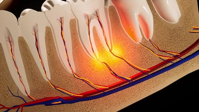 Toothache. Anatomical detailed section of the teeth. Nerve inflammation. 3D animation