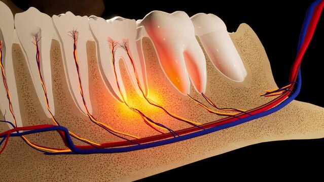 Toothache. Anatomical detailed section of the teeth. Nerve inflammation. 3D animation