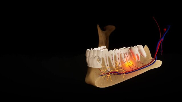 Toothache. Anatomical detailed section of the teeth. Nerve inflammation. 3D animation