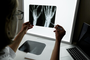 Surgeon Traumatologist  examining an x-ray of the traumatised wrist.