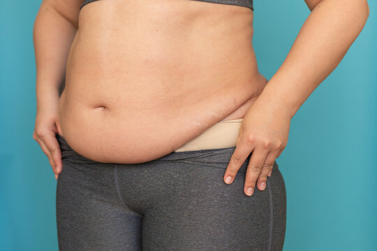 Cropped photo of fat plump plus-size overweight woman wearing grey sports bra, showing excess naked stomach, taking off leggings with hands on blue background. Body positive, obesity, weight loss.