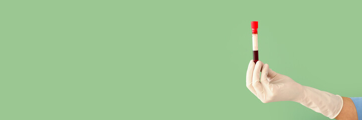 Doctor's hand holding test tube with blood sample on green background with space for text