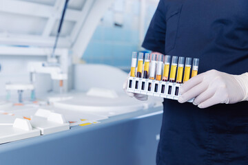 Medical scientist loading samples in robot machine for biochemical automatic testing blood laboratories