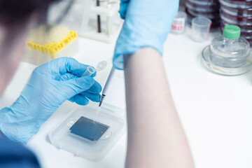 Biochemical analyzer blood tests on modern equipment of laboratories