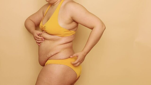 Side view of unrecognizable fat overweight woman wearing yellow bra, bikini, stretching, raising, massaging excess fat of waist on beige background. Body positive, massage, weight loss, liposuction.