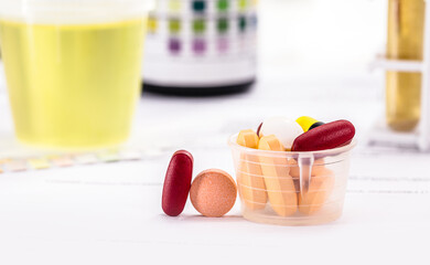 pills and oral medication for diabetes control, spot focus, medical exam result, urine vial in laboratory