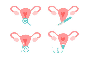 Gynecology icons set. Ultrasound, check up, bacteria test, gynecological surgery.