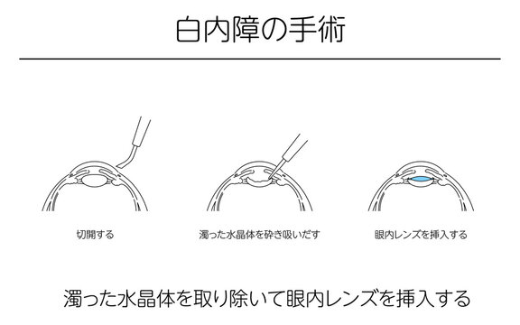 水晶体images Browse 236 Stock Photos Vectors And Video Adobe Stock