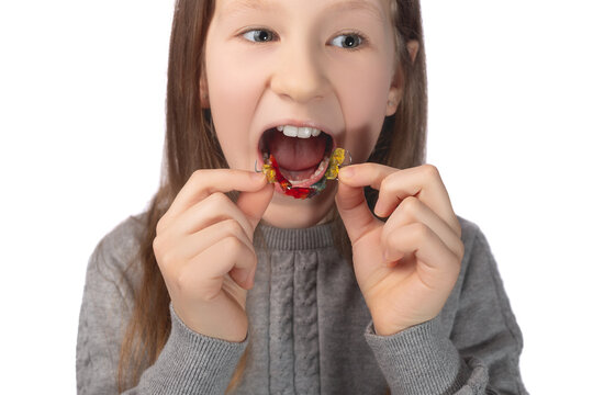 A cute little girl is putting on an orthodontic appliance. The concept of oral hygiene in childhood. Studio photo on a white background.