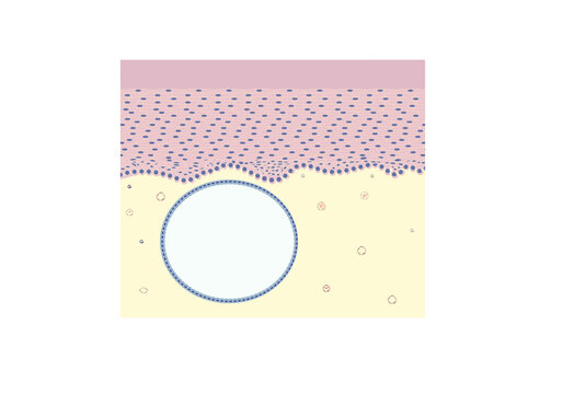 Histology of ovula nabothi under a microscope, vector illustration