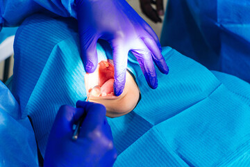 dentist doing an oral examination with the mirror.