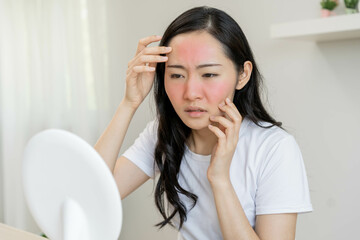 Dermatology, puberty asian young woman, girl looking into mirror, allergy presenting an allergic reaction from cosmetic, red spot or rash on face. Beauty care from skin problem by medical treatment.