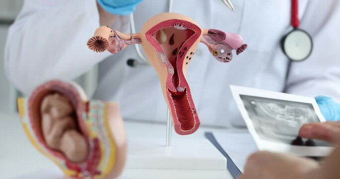 Gynecologist shows anatomy of uterus and ultrasound of ovaries to patient
