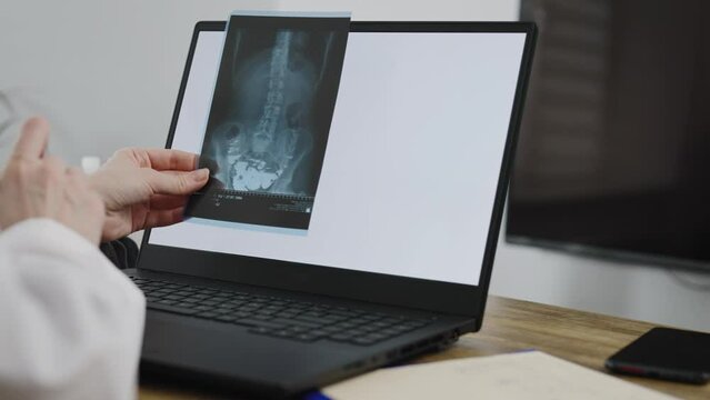 The health worker keeps records of the diagnosis in the patient's medical history. The doctor describes the x-ray