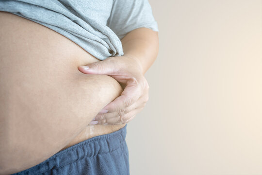 An obesity carrying his chubby belly to show the concept of unhealthy fat man.